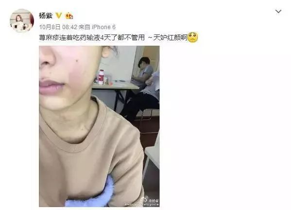 清凉止痒防暑醒神膏,止痒的草药膏