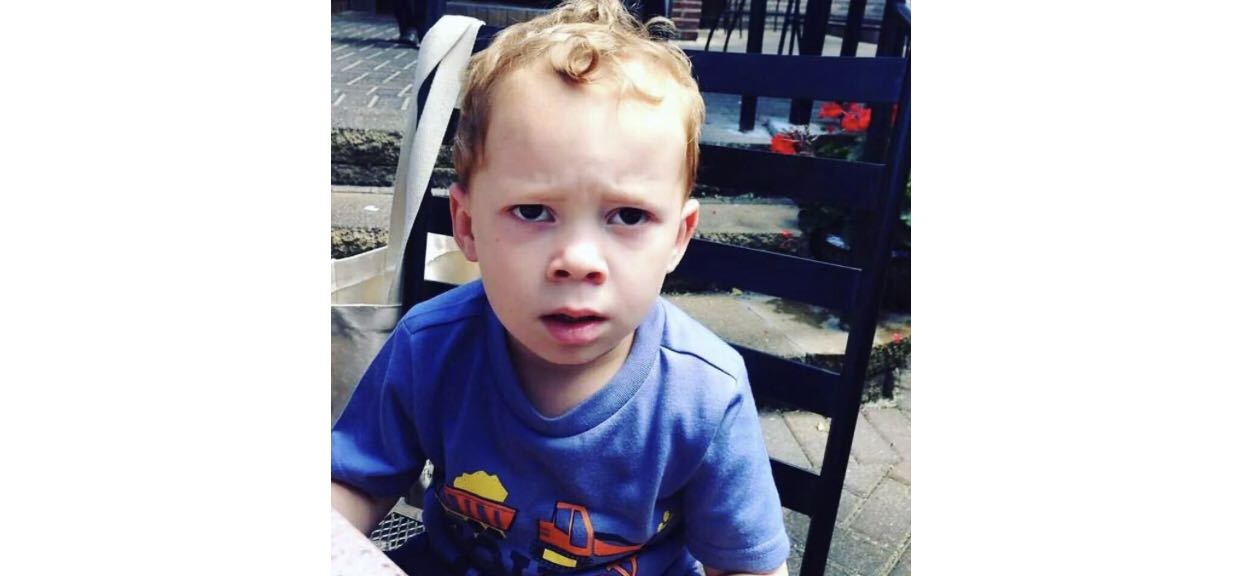 为什么手脱皮以后指纹用不了,一招治愈季节性手脱皮