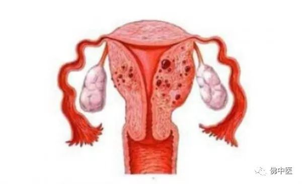 「欣喜」治疗多年痛经，还成功怀上宝宝！佛中医无创技术刷新纪录