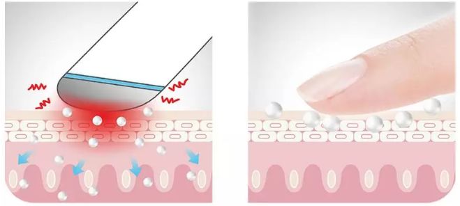 眼袋黑眼圈细纹抹一抹,去眼袋黑眼圈涂抹方法