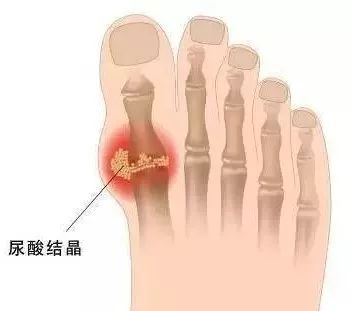 19岁男孩把饮料当水喝，结果脚痛到无法走路！爸爸惊呆……