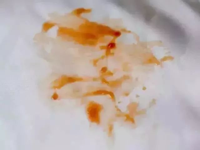 羽绒服脏了教你一招立刻变干净,羽绒服脏了怎么洗掉小窍门