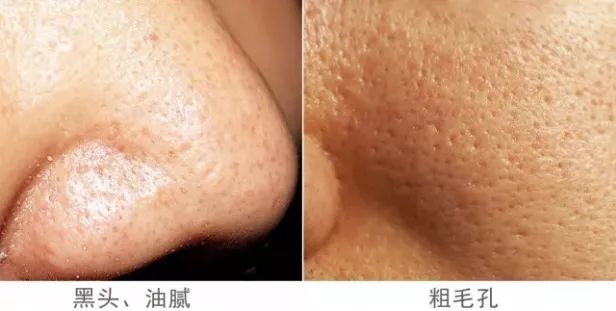 火山泥膜深层清洁面膜测评,嫩肤的白泥面膜评测