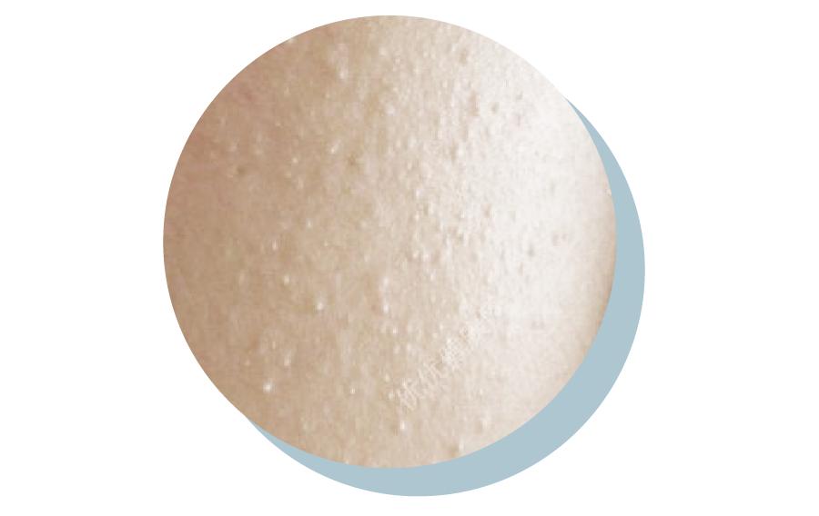 一直在长闭口,为什么总愿意长闭口