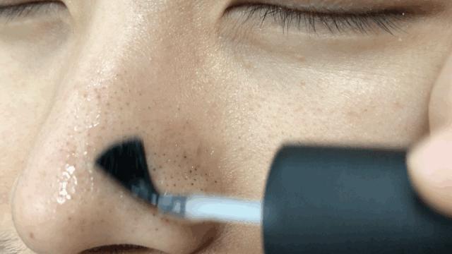 又爽又恶心的去黑头方法来了！5分钟将你10年的黑头白头连根拔起！