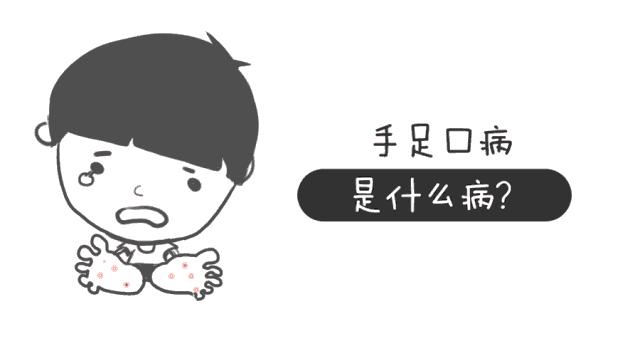 手足口病的介绍,手足口病其实不可怕