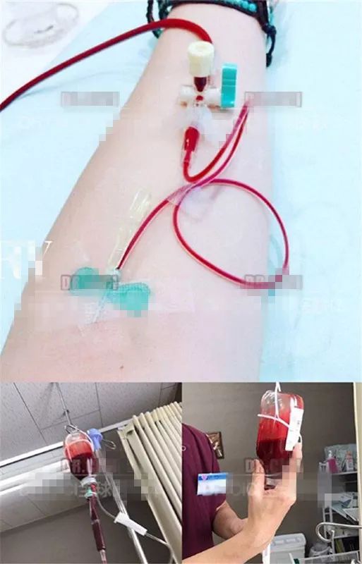 网红魔鬼减肥瘦身法,这些害人的网红减肥法你尝试过吗