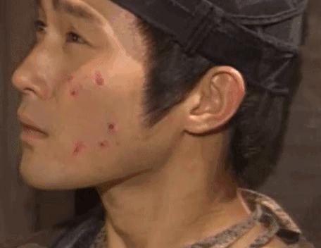 不用洗床单晒被子怎么除螨虫,螨虫去除妙招不用花露水