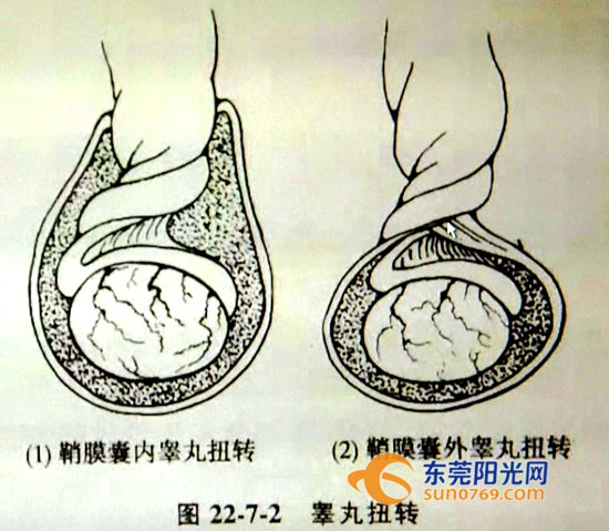 青少年反复疼痛怎么回事,12岁小孩关节酸痛是什么原因