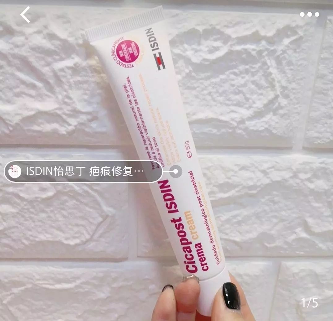 疤痕体质如何去痘印和烫伤印,烫伤色素疤痕修复的最新方法