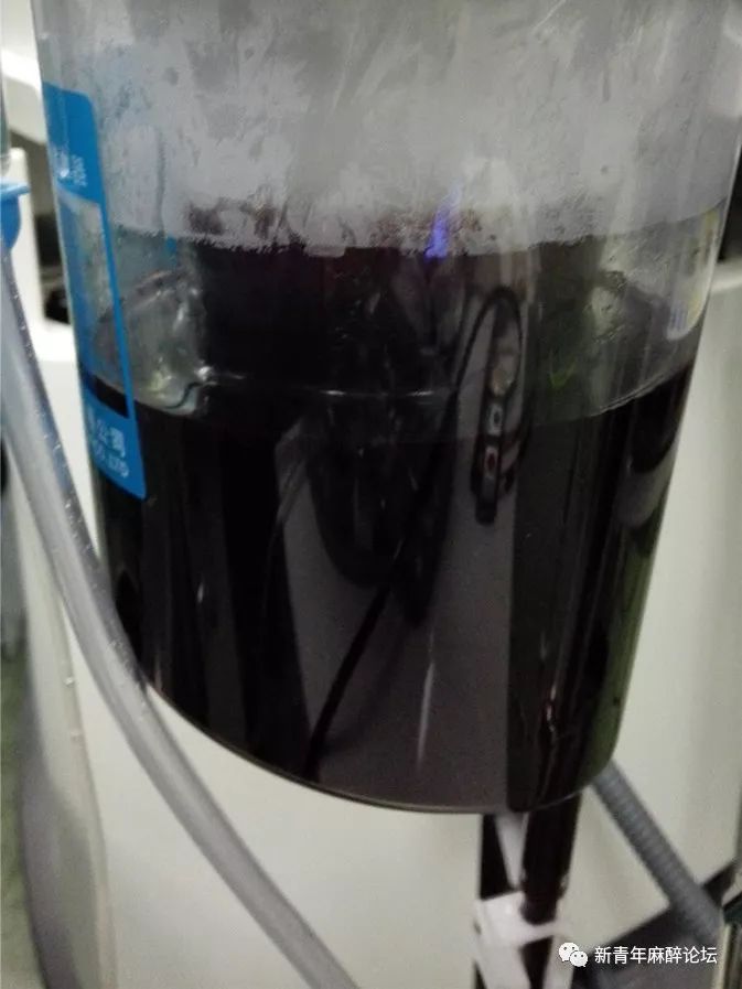 术中自体血回输不良反应,术中血回输