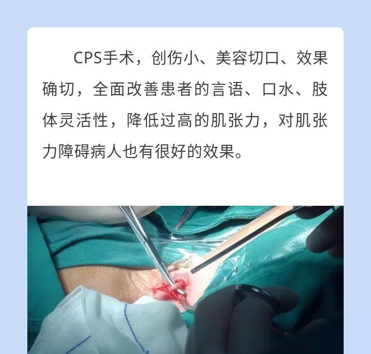 四川八一康复中心脑瘫手术,江西省脑瘫康复中心