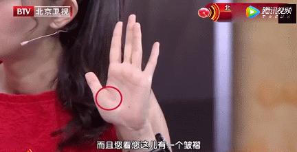 为什么手下垂手背上青筋暴露出来,手血管突出青筋暴起是什么原因