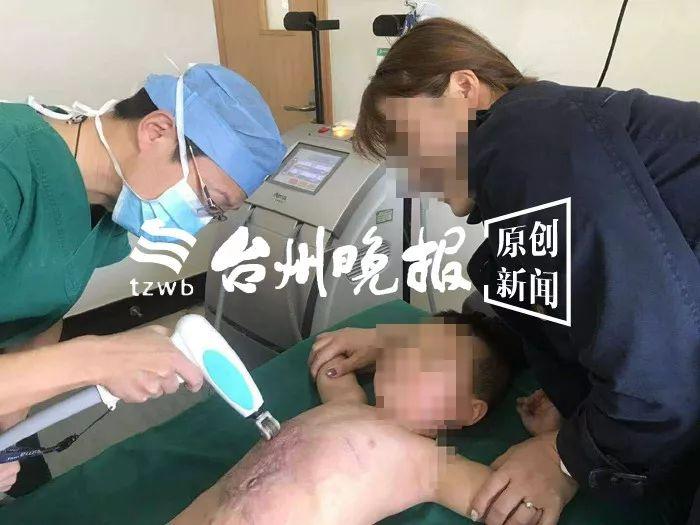 可怜！3岁娃得怪病身上长满“兽皮”，千里寻医到台州