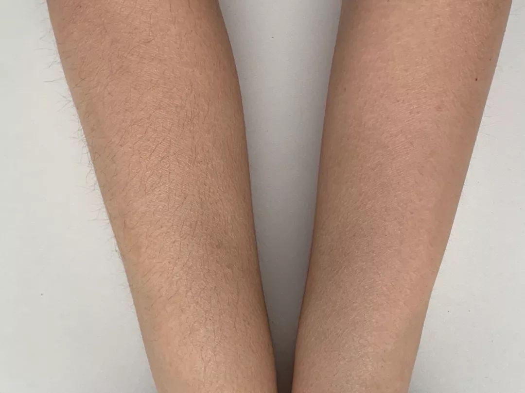 店庆全攻略,店庆攻略