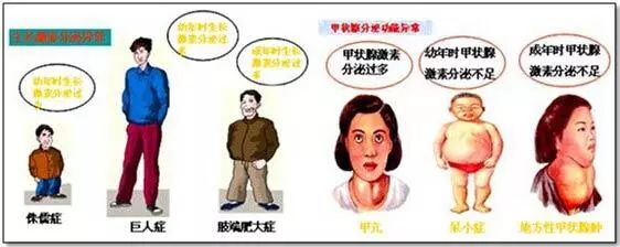 头大脖子粗不是厨子就是伙夫,脖子粗不是厨师下一句是什么