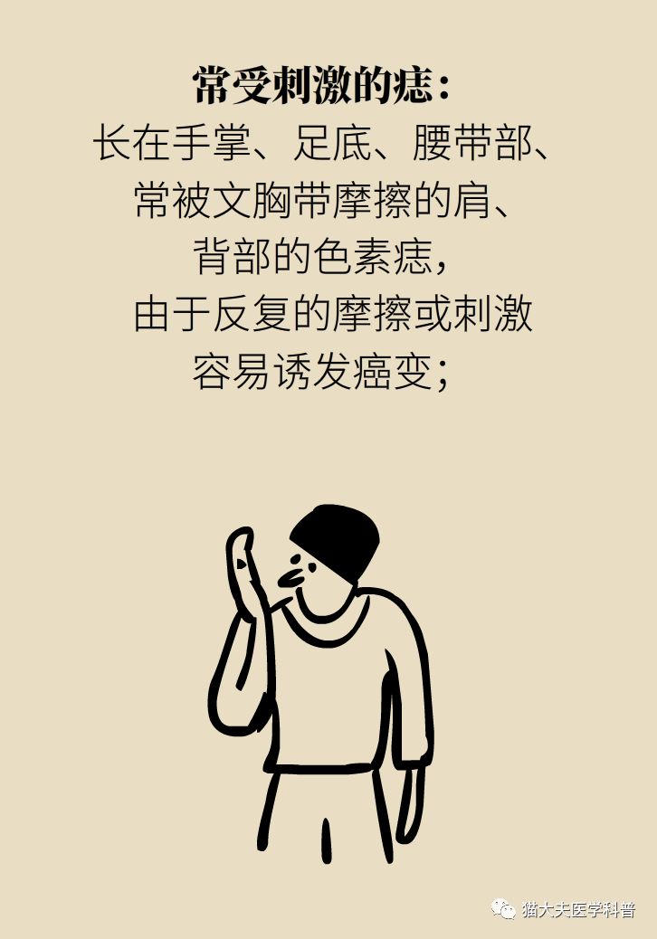 什么症状表明痣已经在恶变,先天性黑素细胞痣恶变的概率大吗