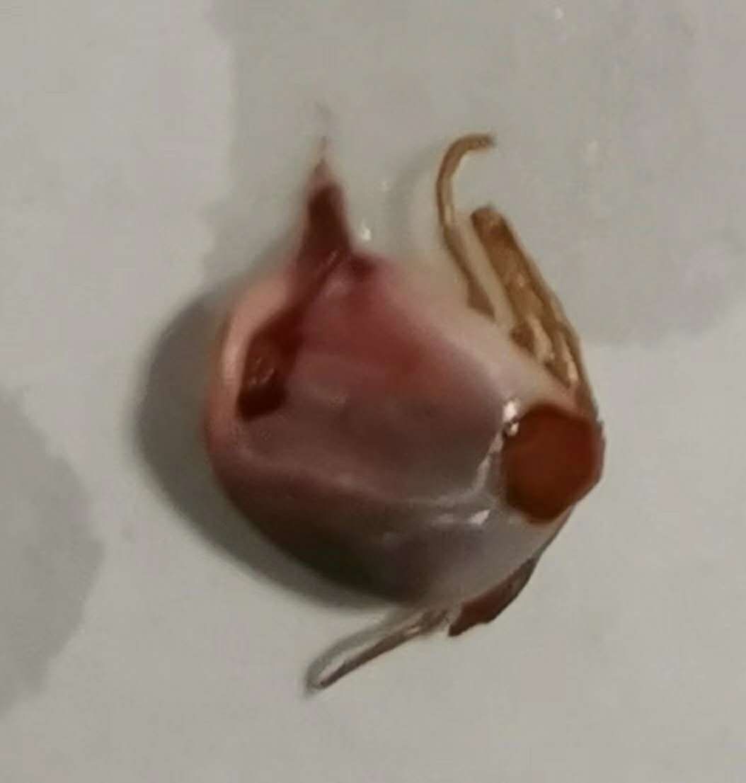 3岁女童头皮有红疙瘩一碰就疼,3岁女童头皮颜色黄怎么回事