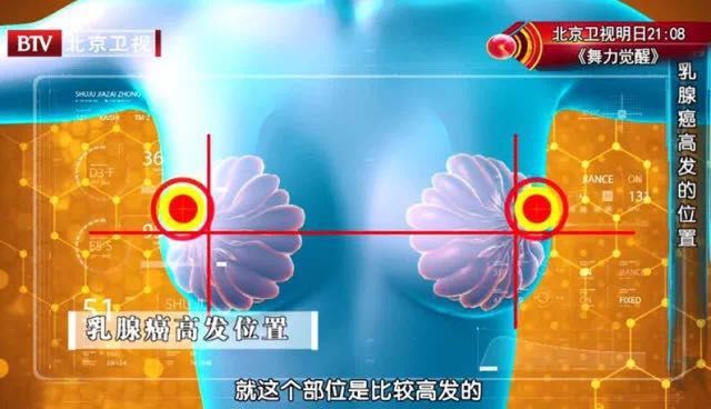 乳腺癌宫颈癌卵巢癌哪个死亡率高,乳腺癌患者容易得宫颈癌吗