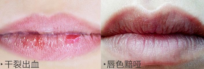 软化死皮淡化唇纹唇膜,唇霜去死皮淡化唇色