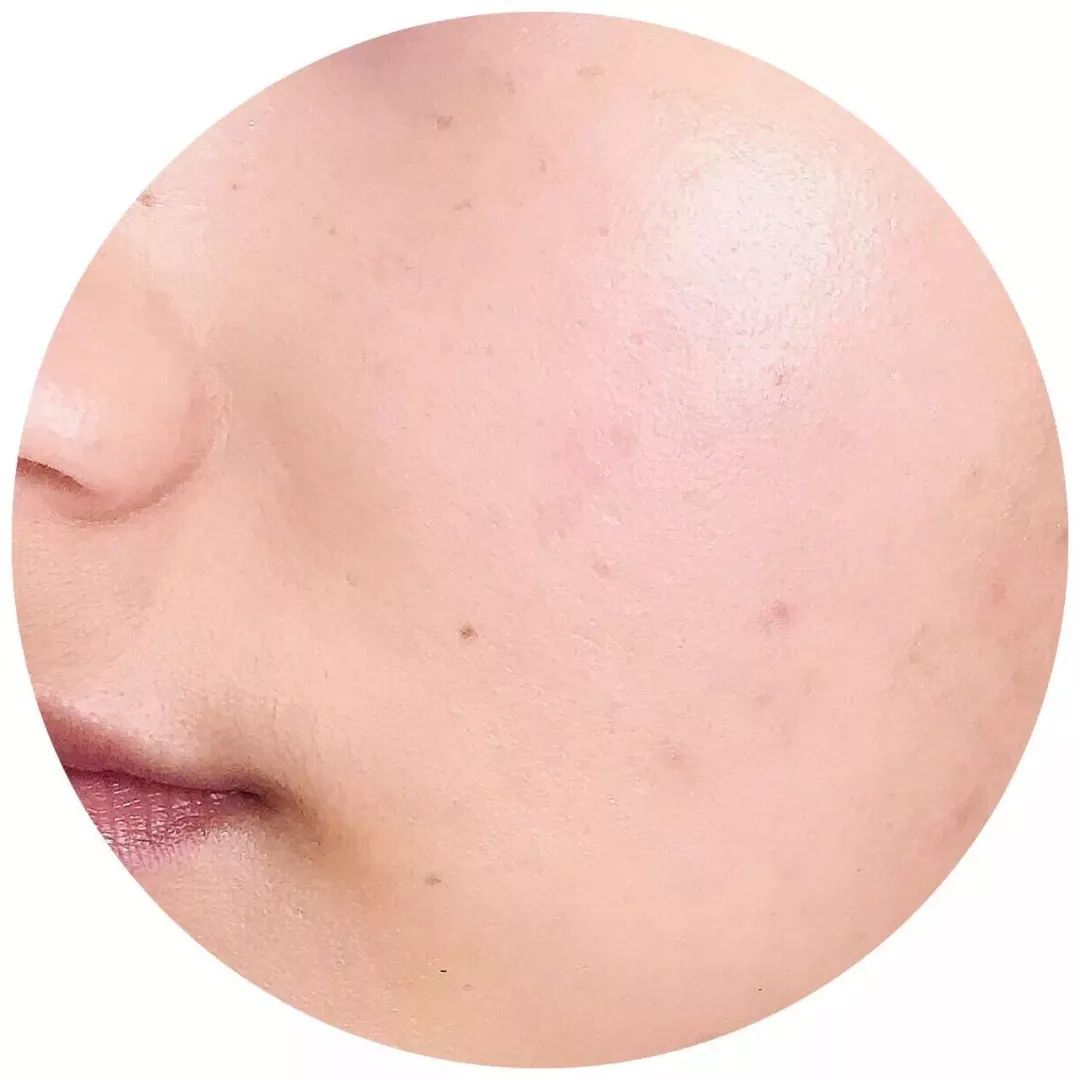 日本最火的8款美白丸,日本美白丸推荐