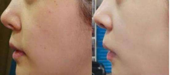 天然强肝剂护肝排毒,护肝排毒产品