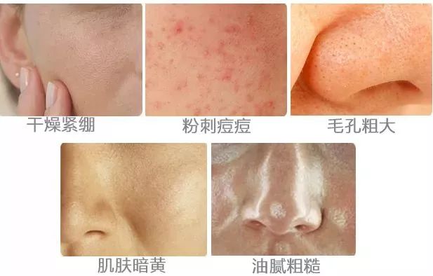 平价化妆水湿敷效果堪比千元面膜,补水平价纯露好物