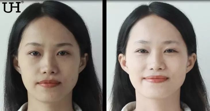 比天猫便宜一半的肌肤自救神器，效果堪比嫩肤针！大牌明星都在用