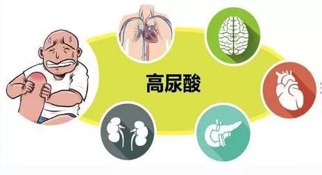 痛风日义诊活动方案,痛风义诊活动