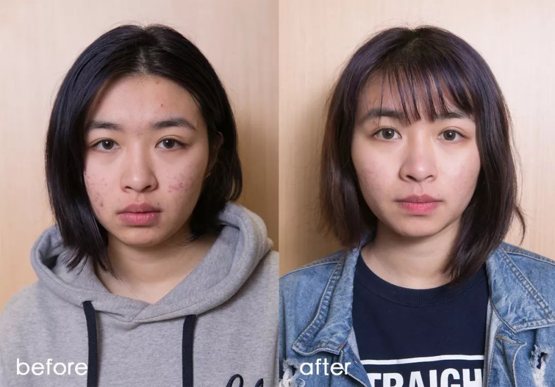 灏忚寕鑲岃瘖瀹ゅ埌搴曟湁澶氬己,灏忚寕鑲岃瘖瀹よˉ姘村悧