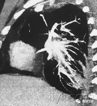 胸部解剖及常见疾病影像表现,胸部影像学基础知识