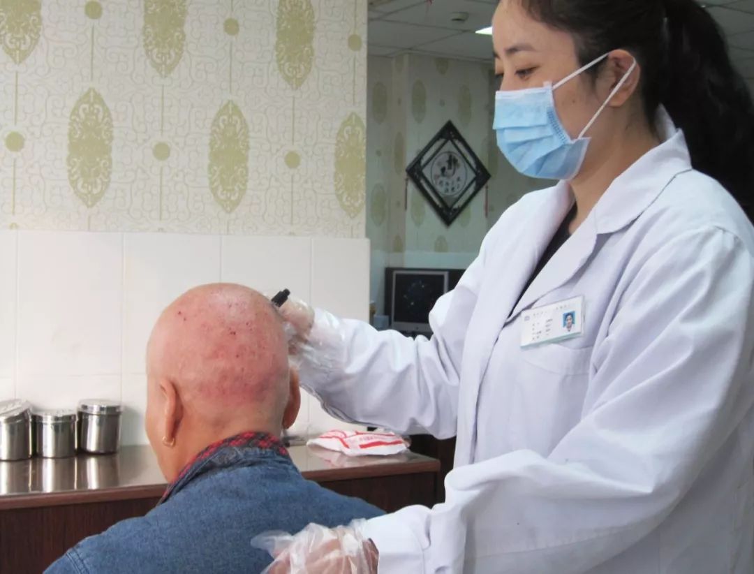 白癜风中医可以治愈吗,白癜风中药能除根吗