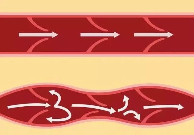 为什么挤痘痘会挤进icu,挤掉痘痘后留了个洞