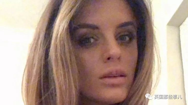 丰唇后肿成香肠嘴过几天会消失吗,在朋友家里玩香肠派对