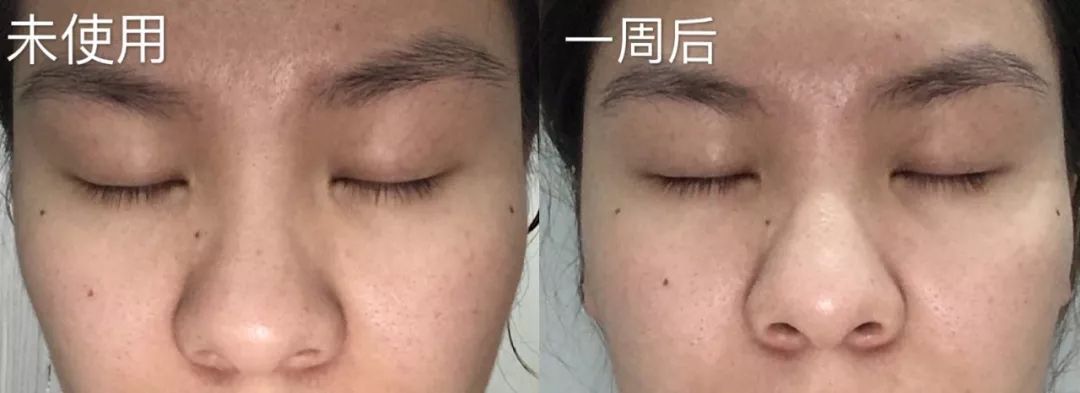 盲测14天揭密|年轻肌特训营收关，那瓶好评如潮的精华水究竟是谁？