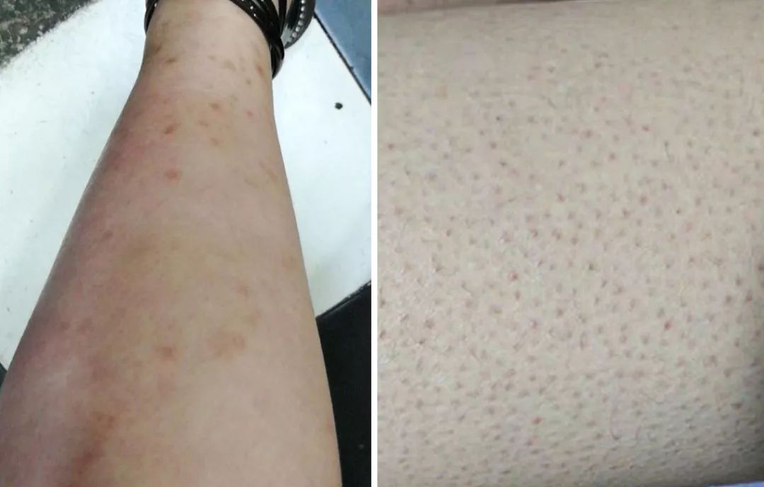 这才是夏天的光腿神器,可以遮腿毛的光腿神器