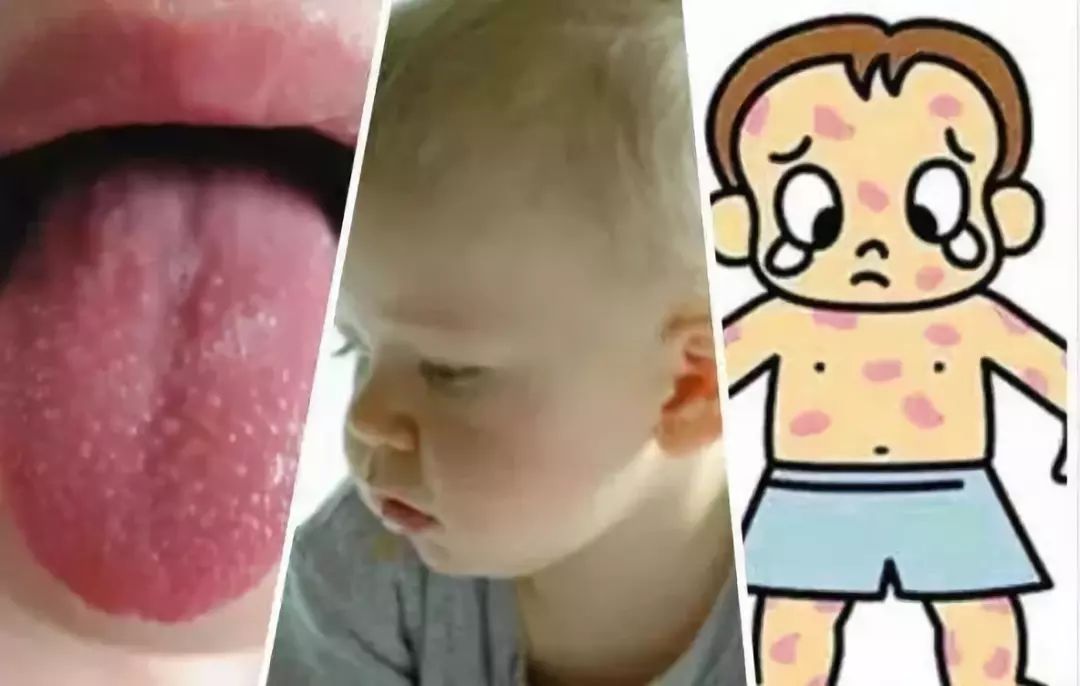 紧急提醒这种病进入高发季,淄博市紧急通报