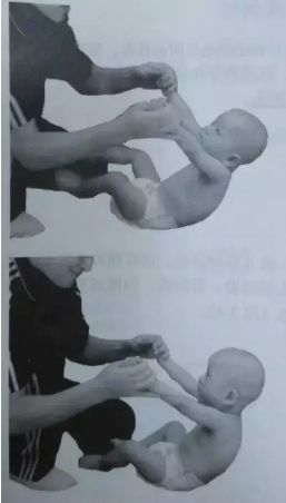 脑瘫儿童头往后仰怎么锻炼,脑瘫儿童抽搐四肢无力怎么办