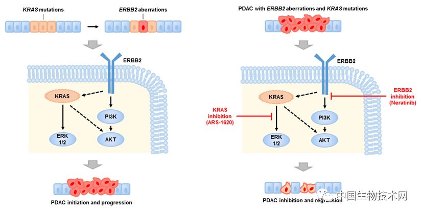 胰腺癌药物研究大突破,胰腺癌新靶点治疗