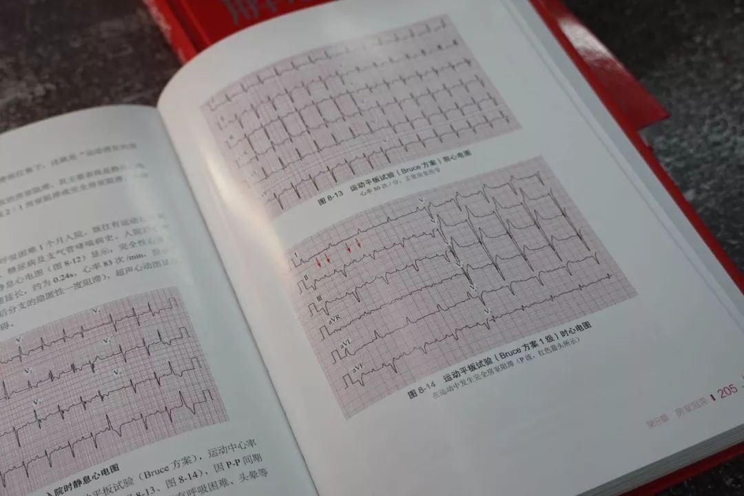 心电图的“红宝书”—《心电解惑》｜新书速递