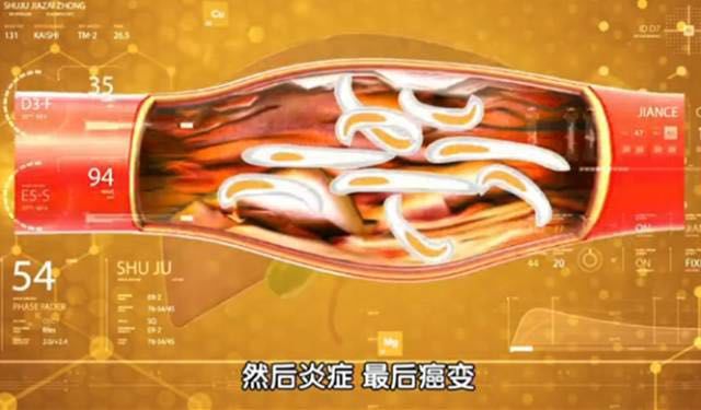 细菌病毒感染导致癌症,20多种癌症