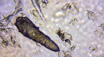 教你1分钟清除99%的脸上螨虫,10秒祛螨虫的药膏