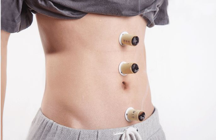 艾灸哪个穴位祛湿效果最好,艾灸贴肚脐祛湿有效果吗