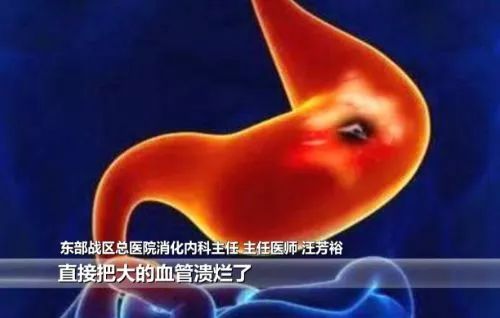 男子熬夜10天后大出血，体内一半血流光，医生：身上这个征兆要留心！