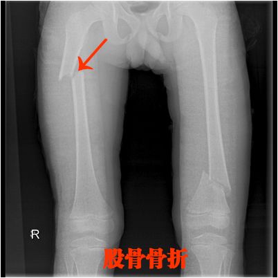 执医技能：X线阅片，全是套路，超简单