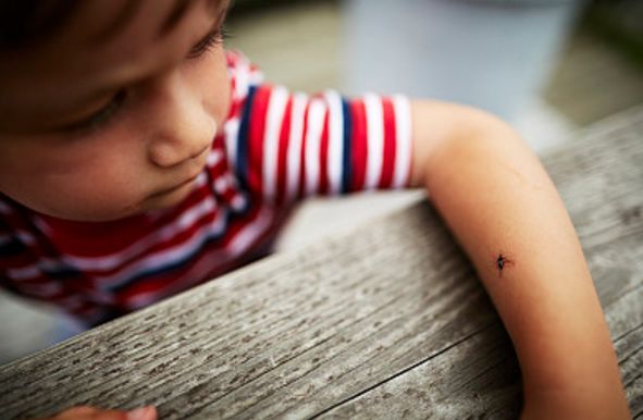 使用！总被蚊子咬？涂点这个马上止痒