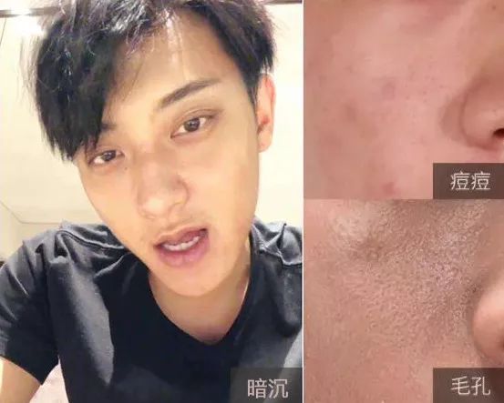 晒一天太阳就黑了怎样变白,暴晒一天晒黑了