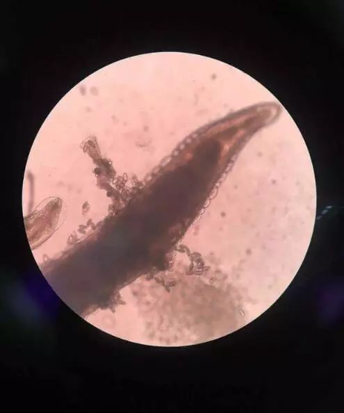 孩子屁股痒怎么办最有效的方法,孩子屁股痒怎么可以止痒