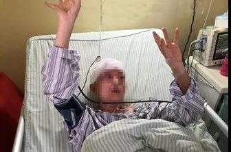 38岁女人每晚做梦是什么原因,42岁女得脑胶质瘤