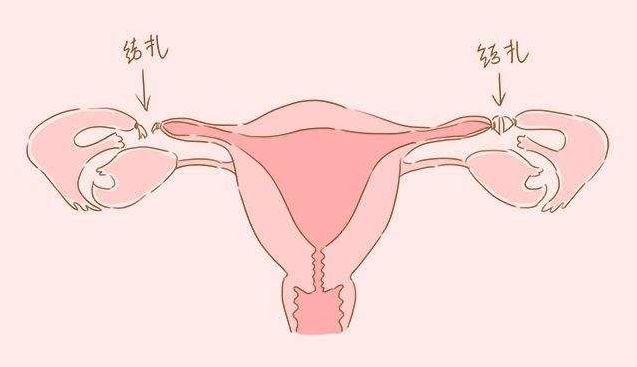 这3种避孕方式并不靠谱,这3种避孕方法其实并不靠谱